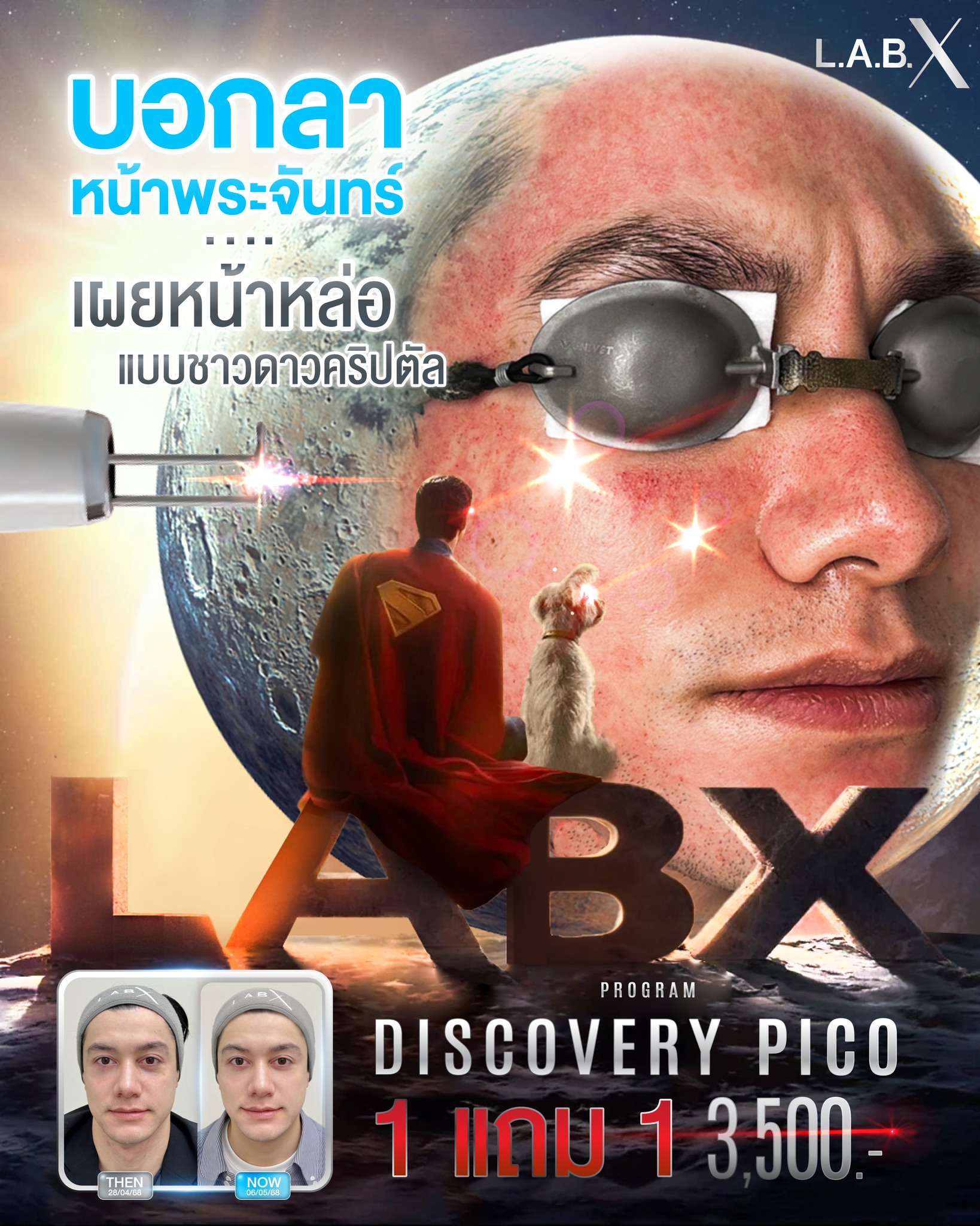 LABX - หน้าใส ไม่มีเพี๊ยน LABX Discovery Pico เครื่องแท้อันดับ 1 ใน ...