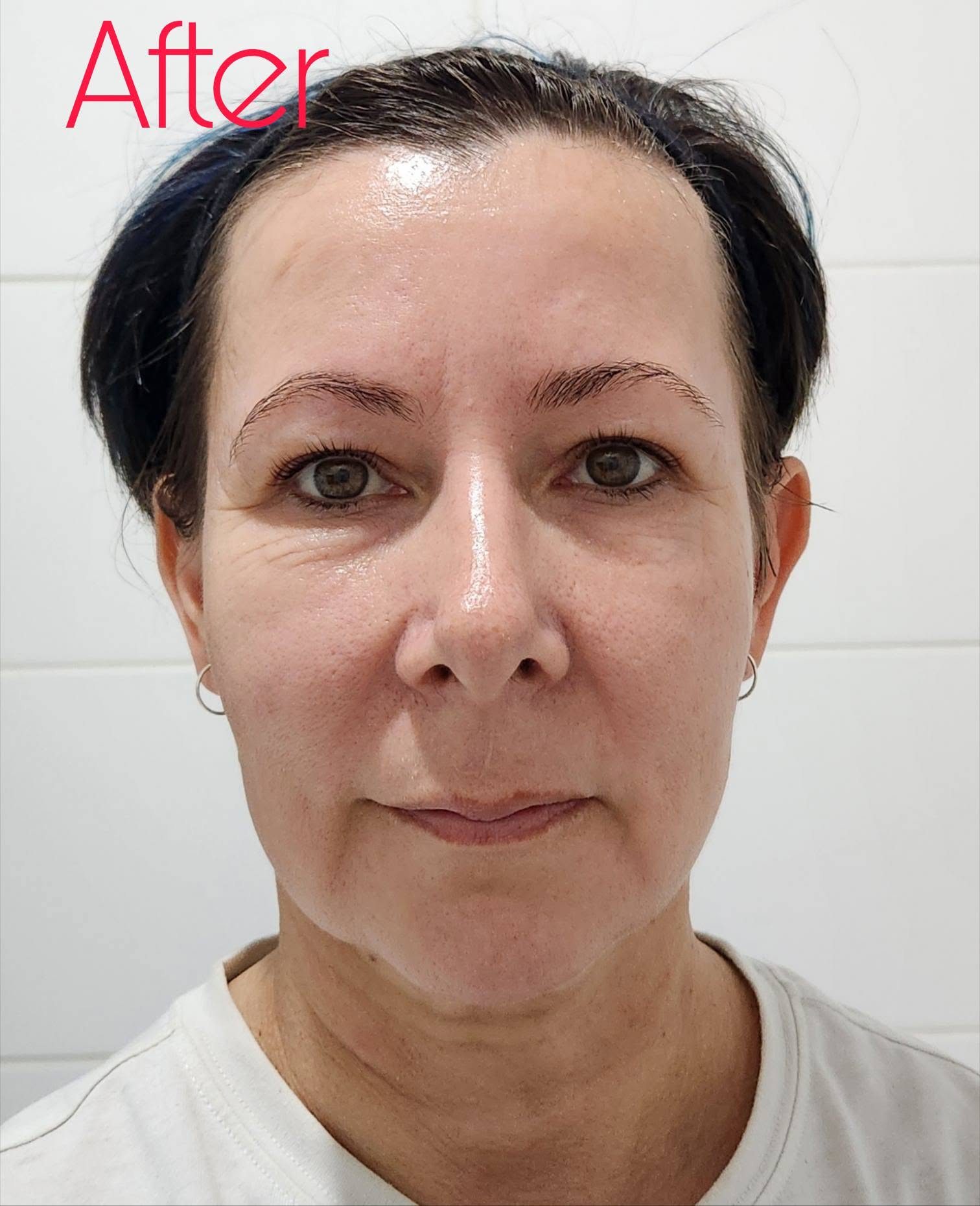 ghk cu peptide reviews before and after Derma TX GHK-Cu Copper Review For Softer Wrinkles Connection Size:1/2