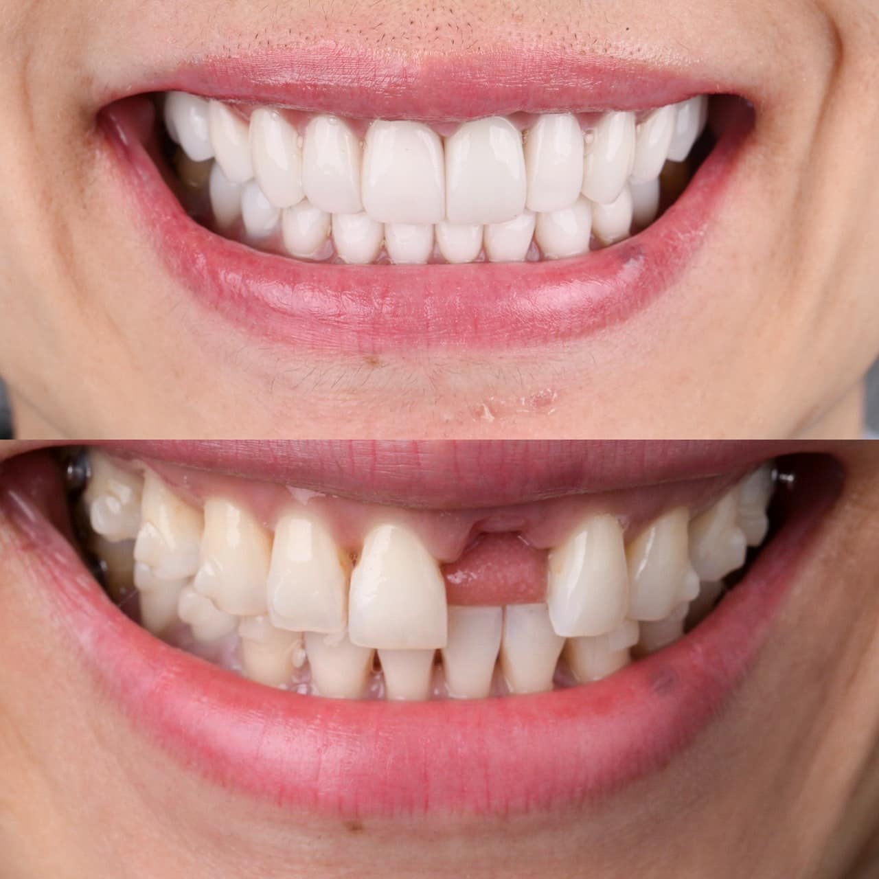ATTA Dental Lab - ATTA Dental Lab updated their cover photo.