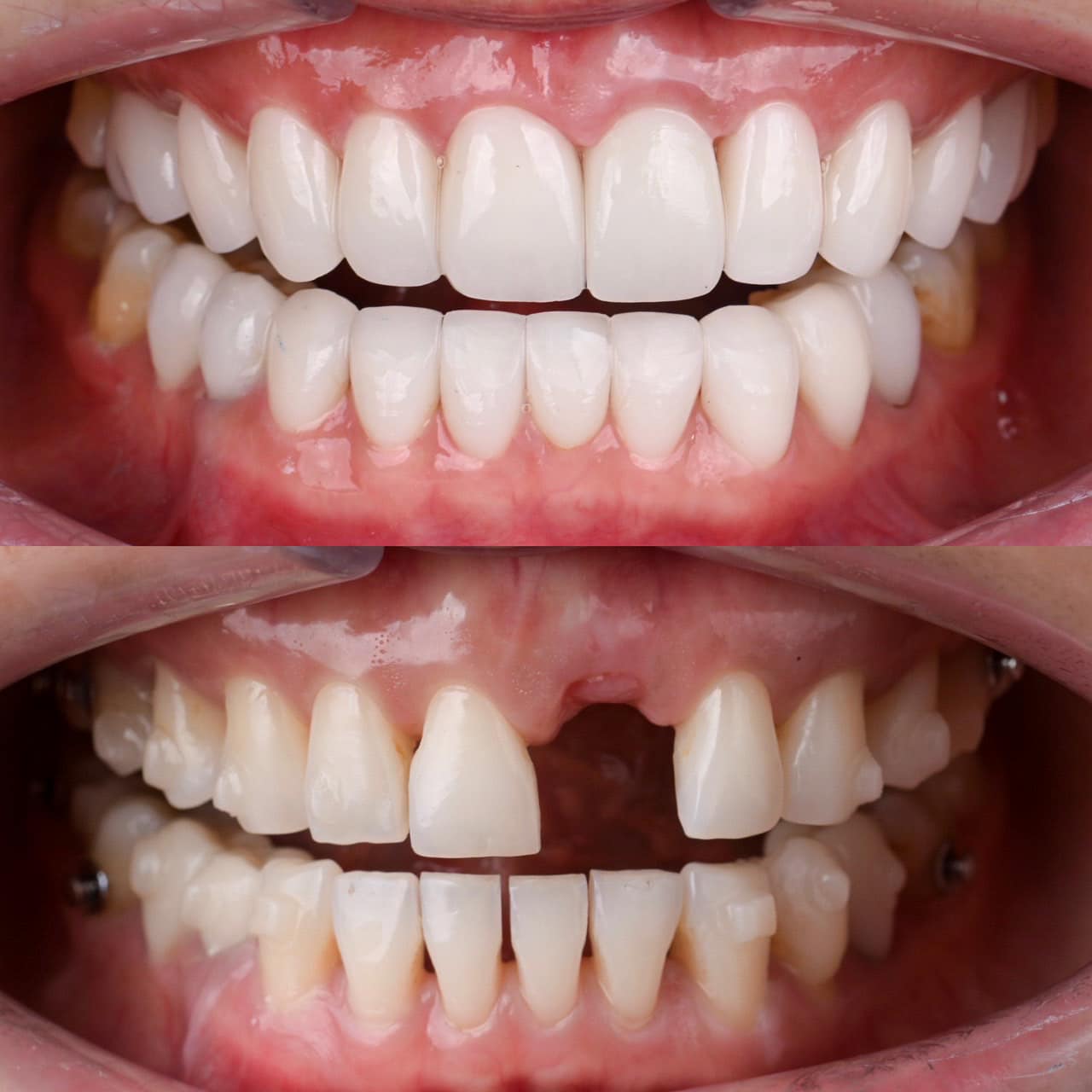 ATTA Dental Lab | Bangkok