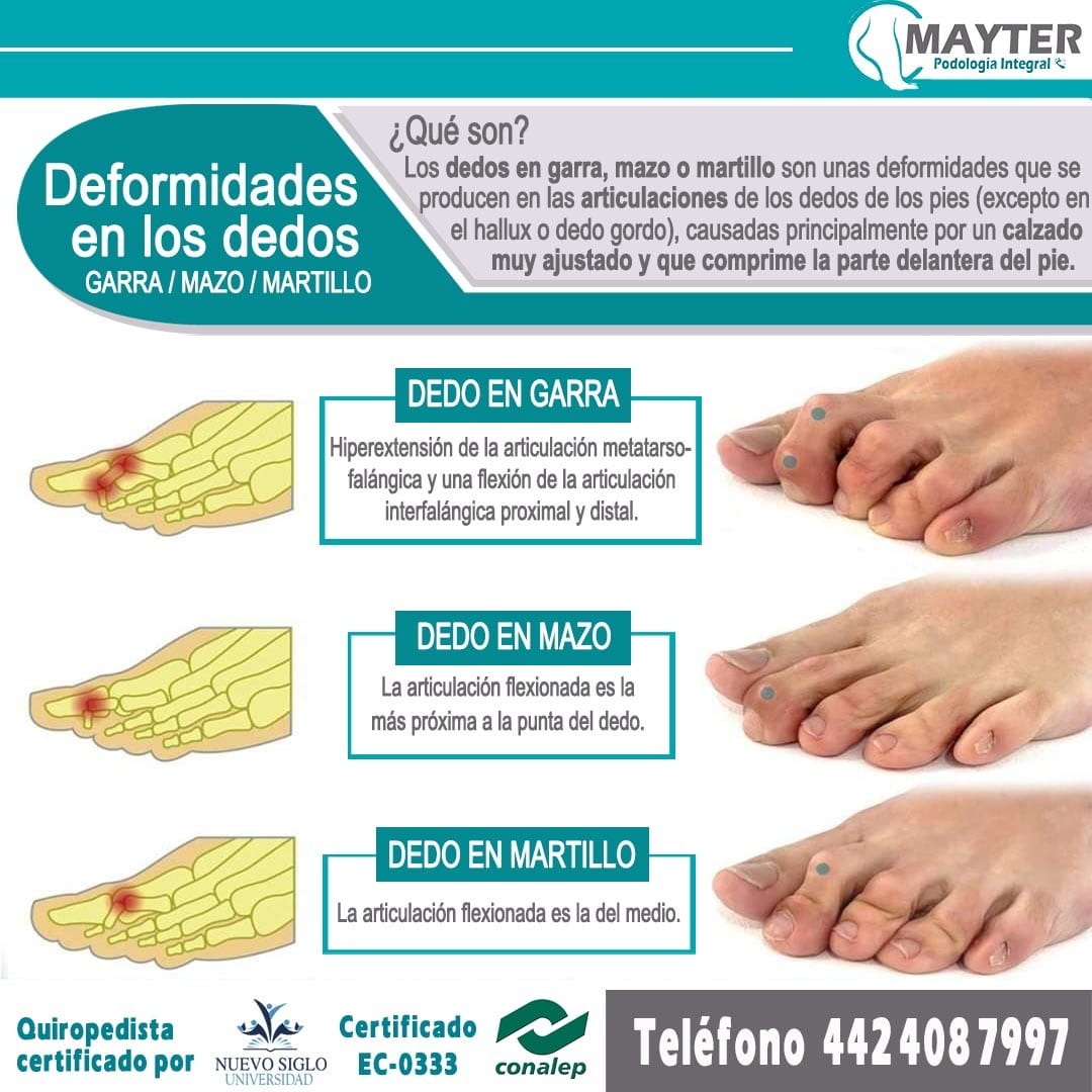 Conoce... - Podologia Integral Mayter Enfermera y Podologa