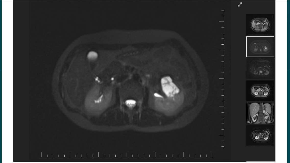 Radiology Case Cafe