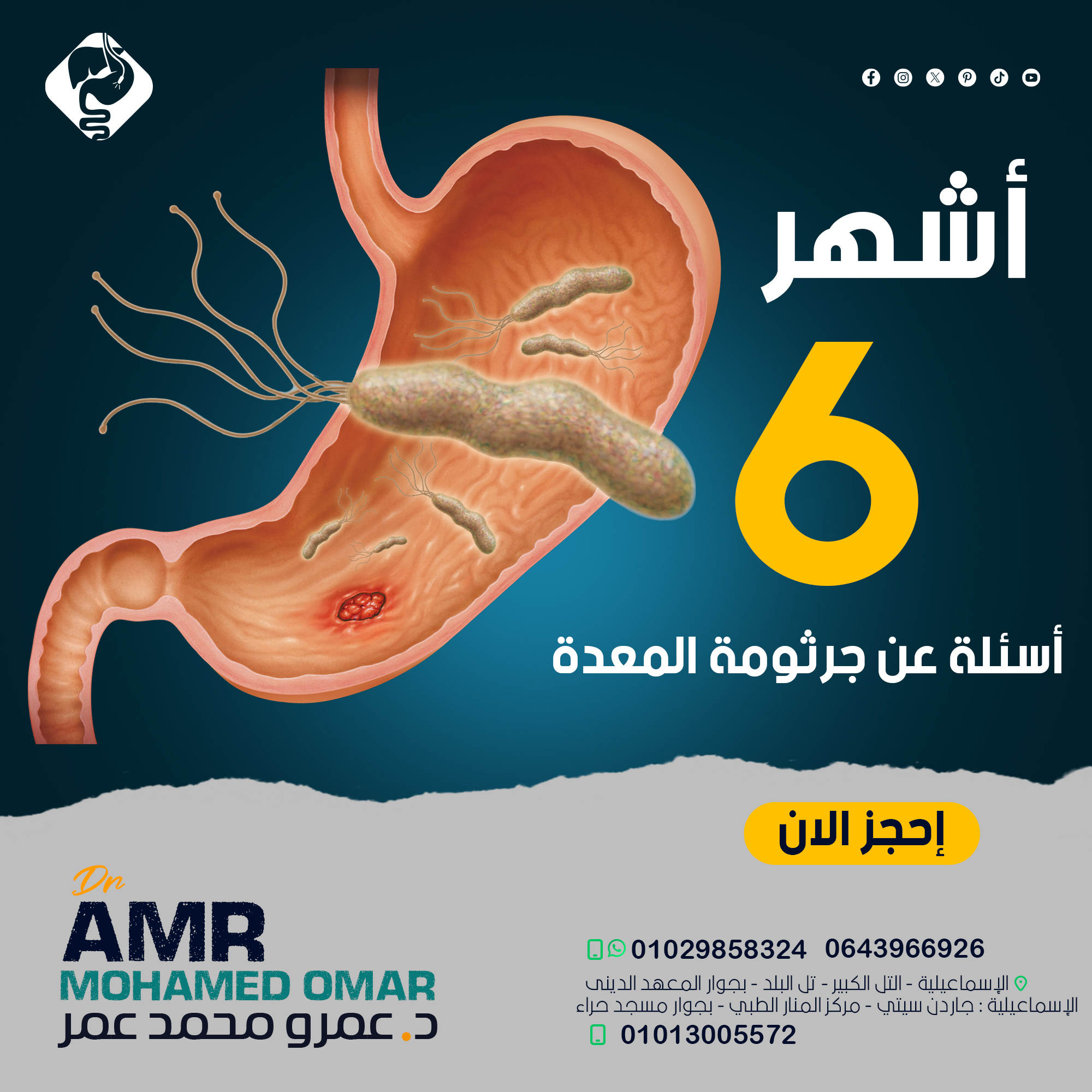 أشهر 6 أسئلة عن... - Dr. Amr Mohamed Omar - د عمرو محمد عمر