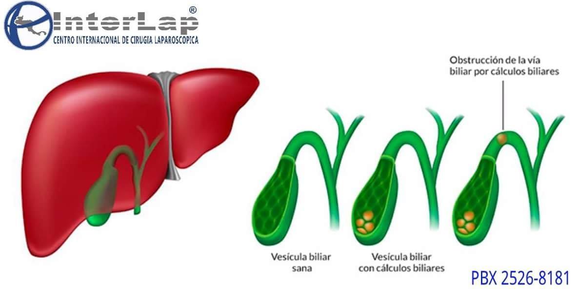 COMPARTA SALUD...... - Interlap - Centro Médico Internacional | Facebook