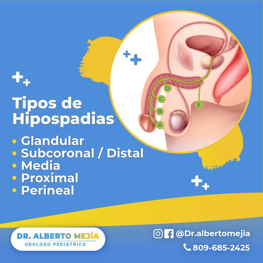 Dr. - Hay varios tipos de hipospadias, que suelen describirse de ...