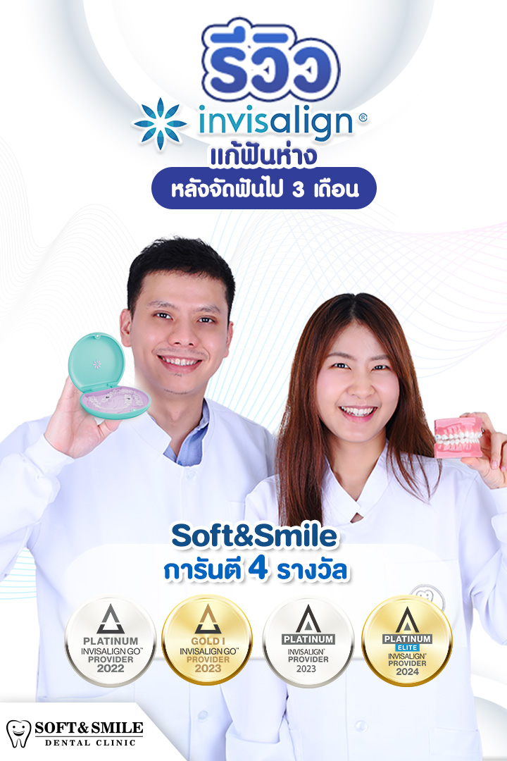 📌 รีวิวจริง! Invisalign แก้ฟันห่าง หลังจัดฟันไป 3 เดือน . เคยจัดฟันแล้ว ...
