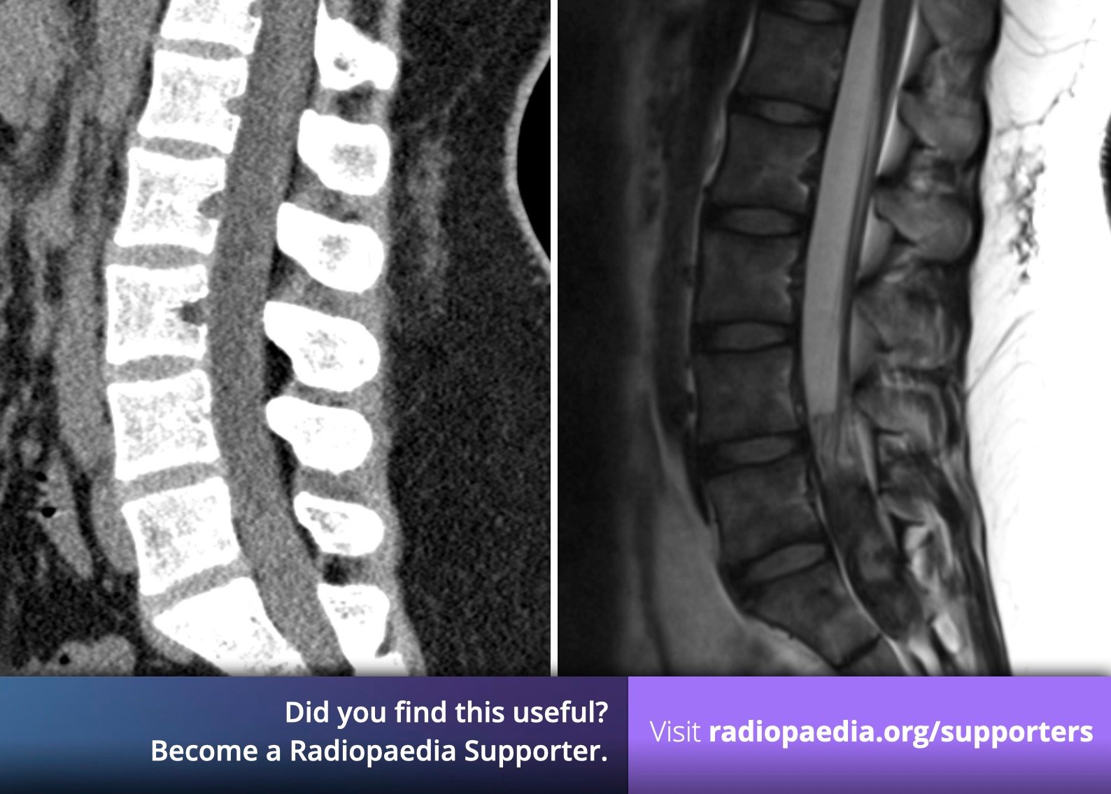 Neuroradiology - Radiopaedia.org
