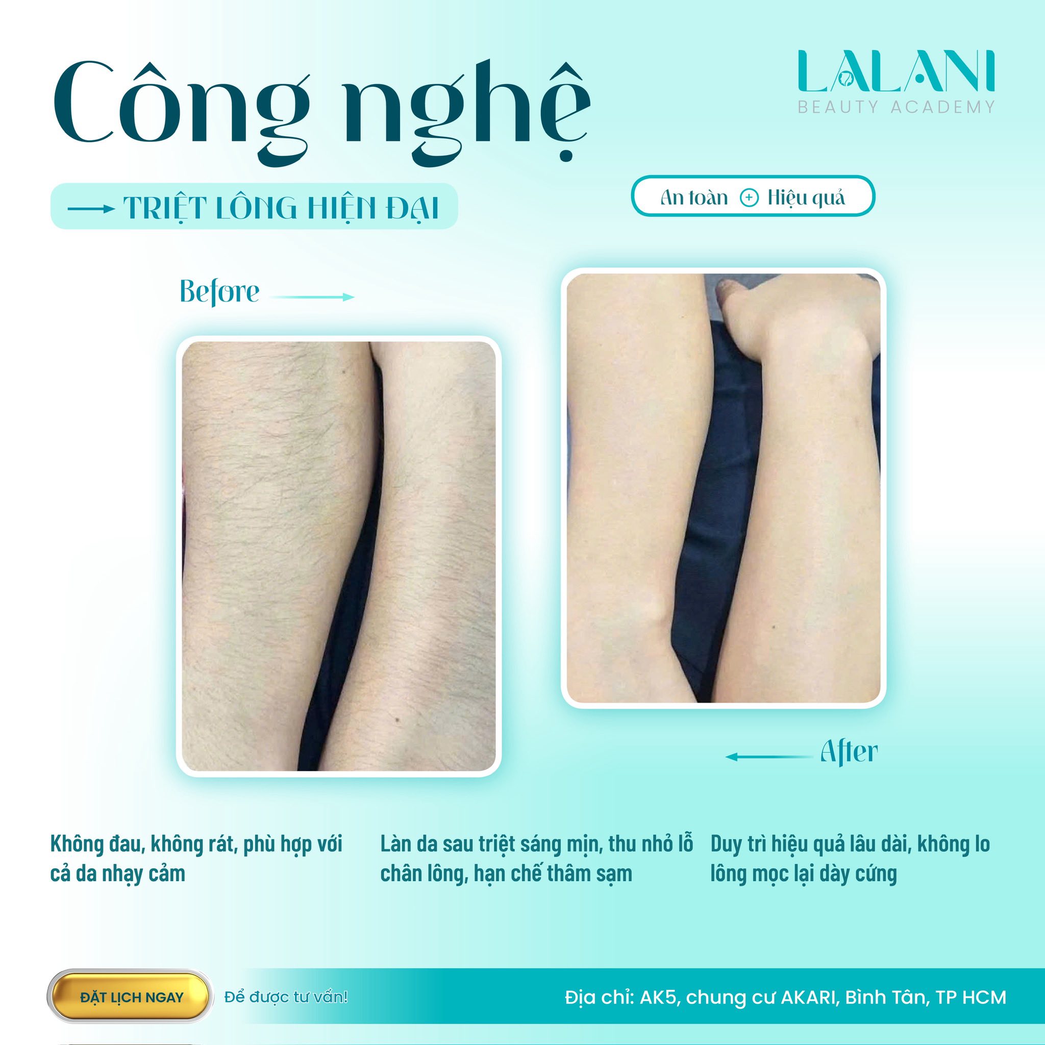 LaLani Beauty Spa - Đẹp hơn mỗi ngày | Ho Chi Minh City