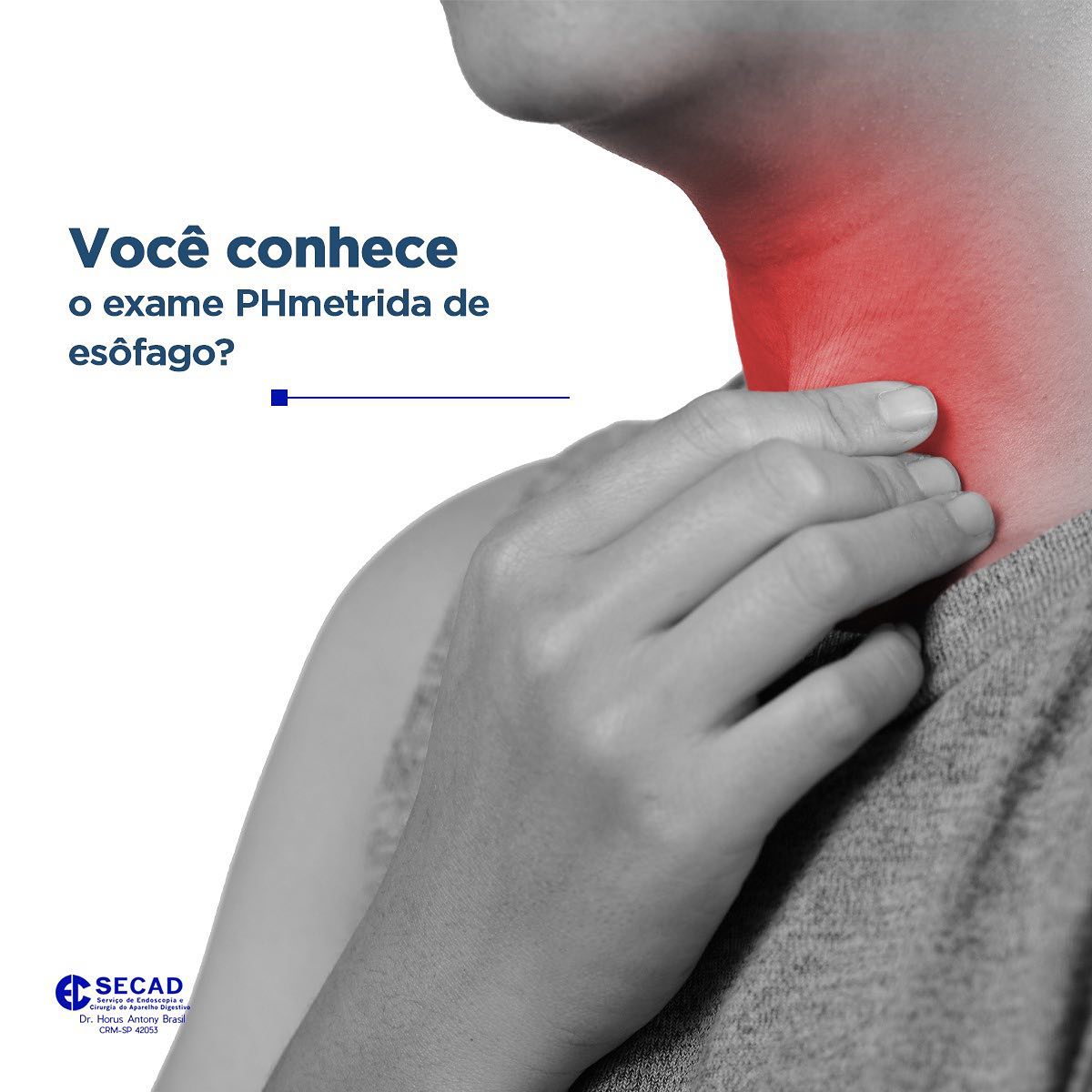 Clínica Secad - A pHmetria esofágica é o exame indicado... | Facebook