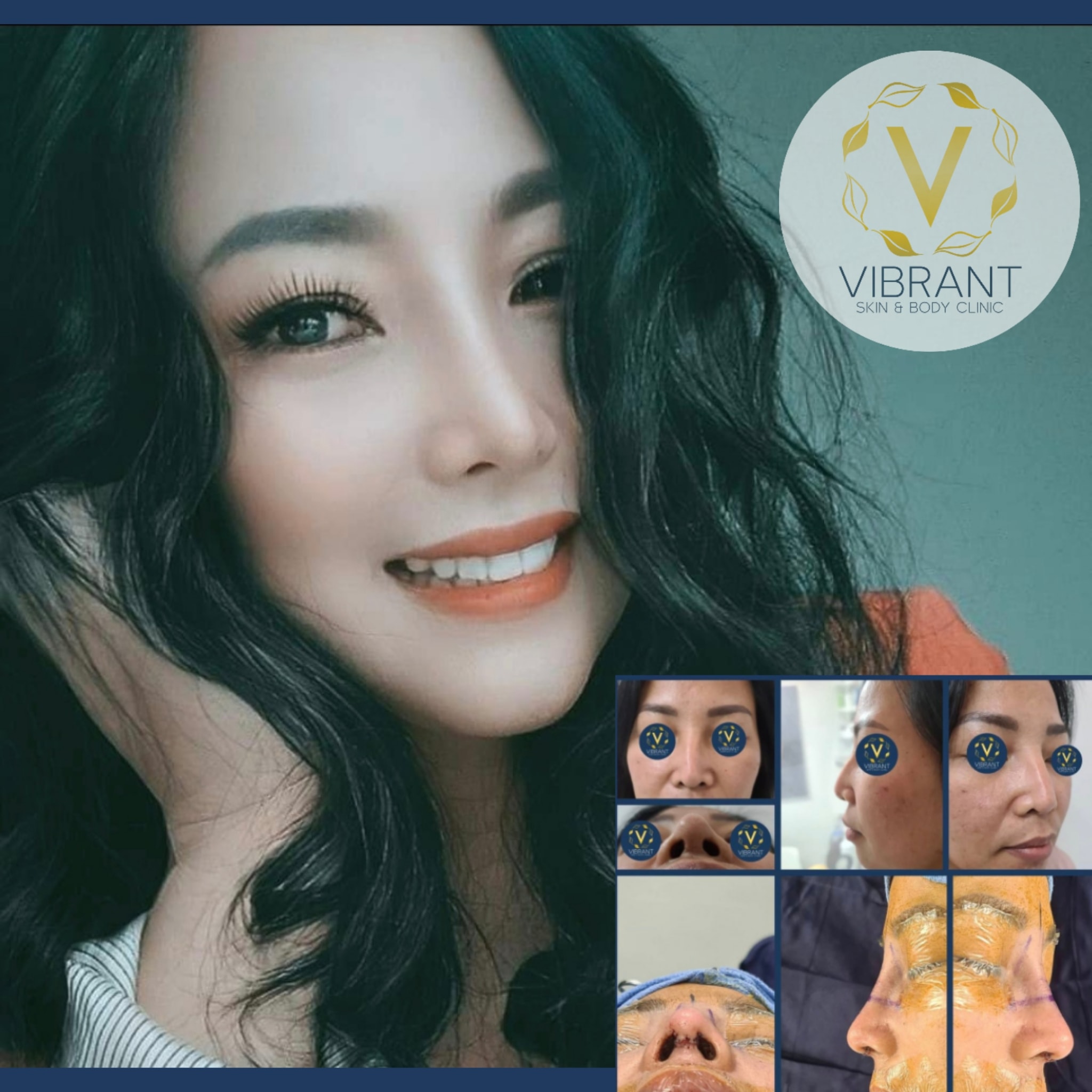 MY BEFORE,... - Vibrant Skin & Body Clinic by Dr. Ordillo