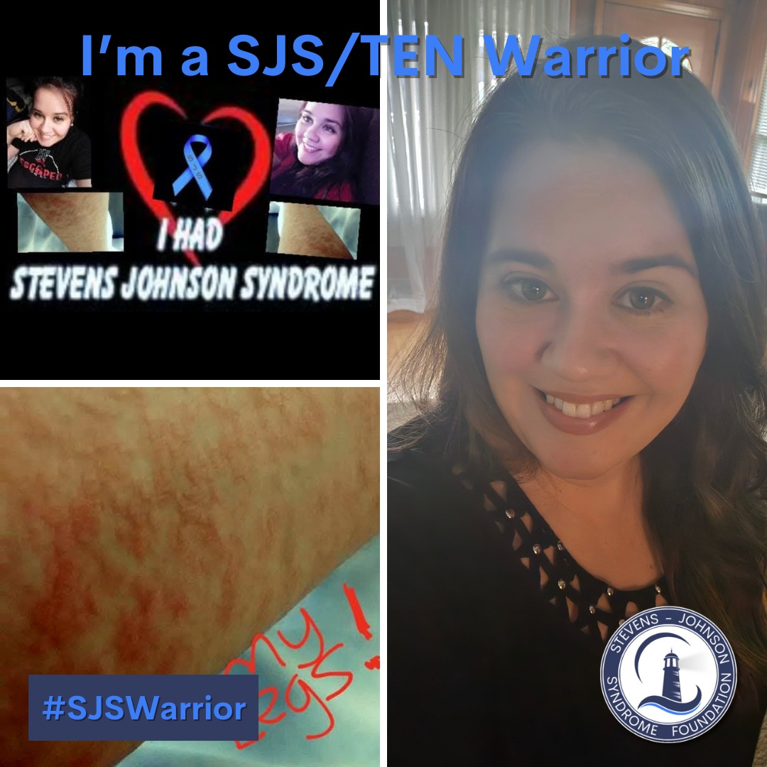 Stevens Johnson Syndrome Grief Support - In honor of August being SJS ...