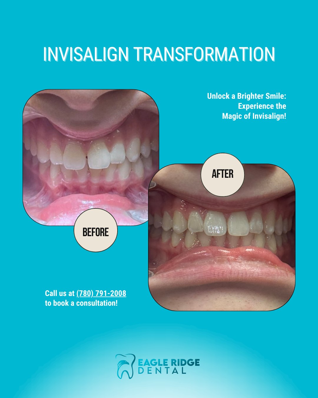 Eagle - 🌟 Check out the remarkable journey of our patient who used ...