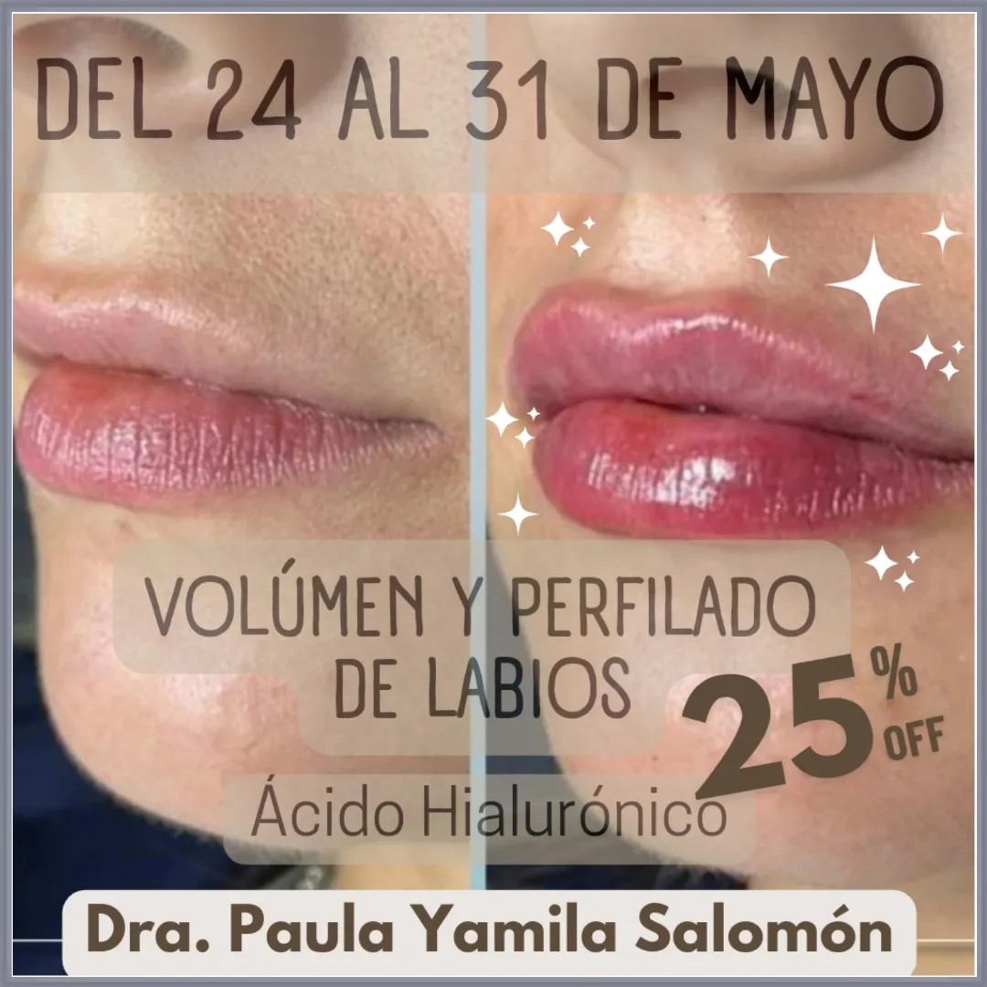 Medicina Estética Dra. Paula Yamila Salomón | Barracas