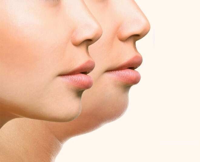 Healthylifebasics How To Lose Fat In Your Face 8 Effective Tips To Lose Fat In Your Face Losing Weight Can Be A Challenge On Its Own Let Alone Losing Weight From
