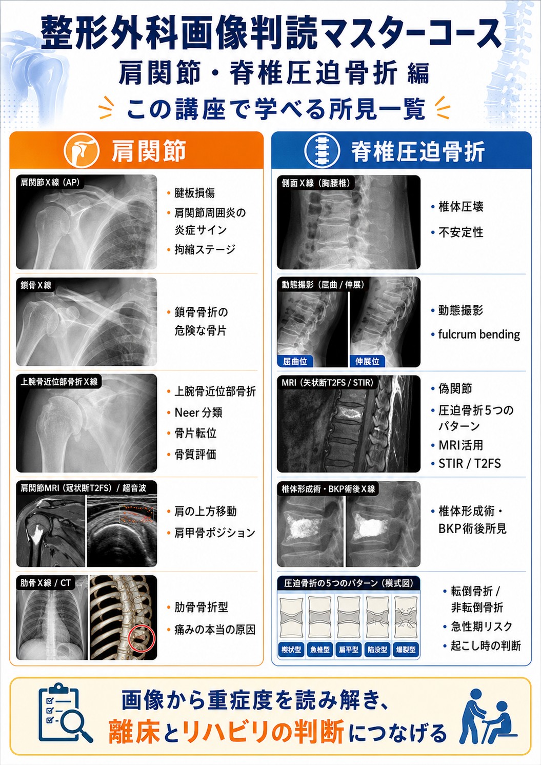 学べる所見一覧を公開！ 】 肩・脊椎画像からリハ判断が変わる 整形