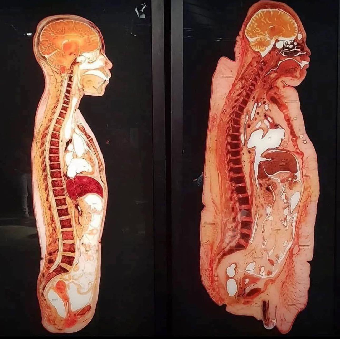 Anatomie - Ein sehr interessanter anatomischer Schnitt, der den ...