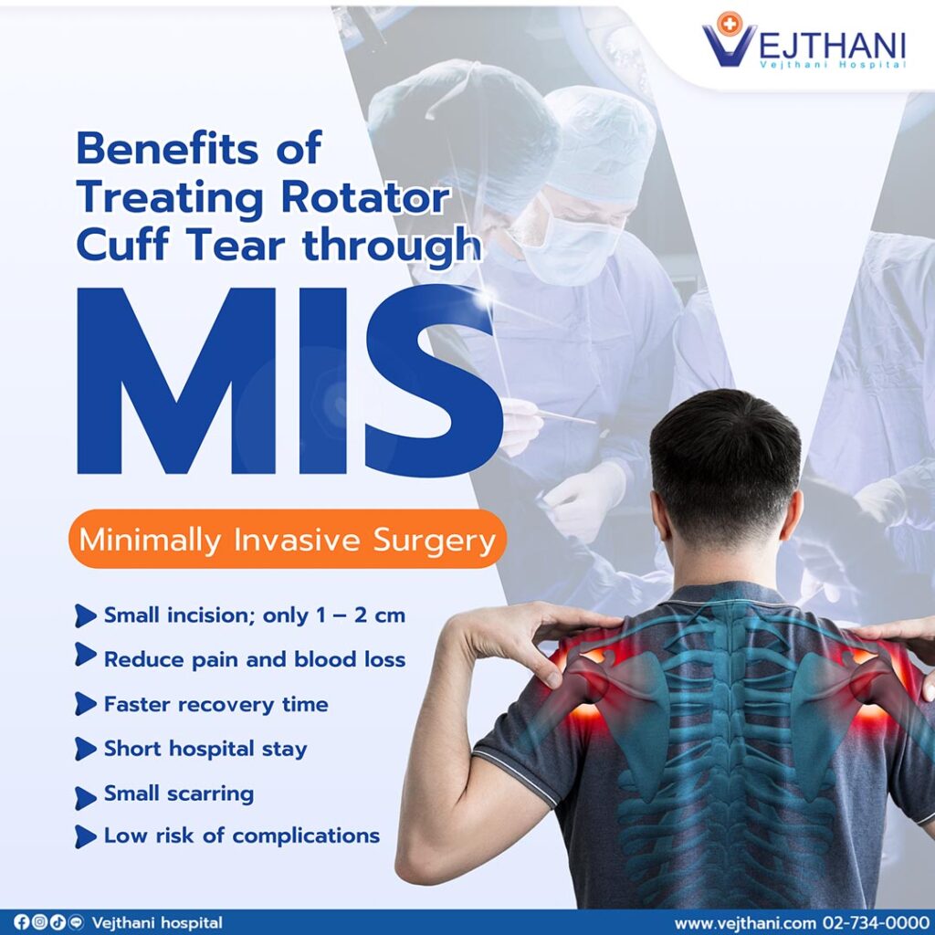 Vejthani - Benefits of Treating Rotator Cuff Tear through Endoscopic ...