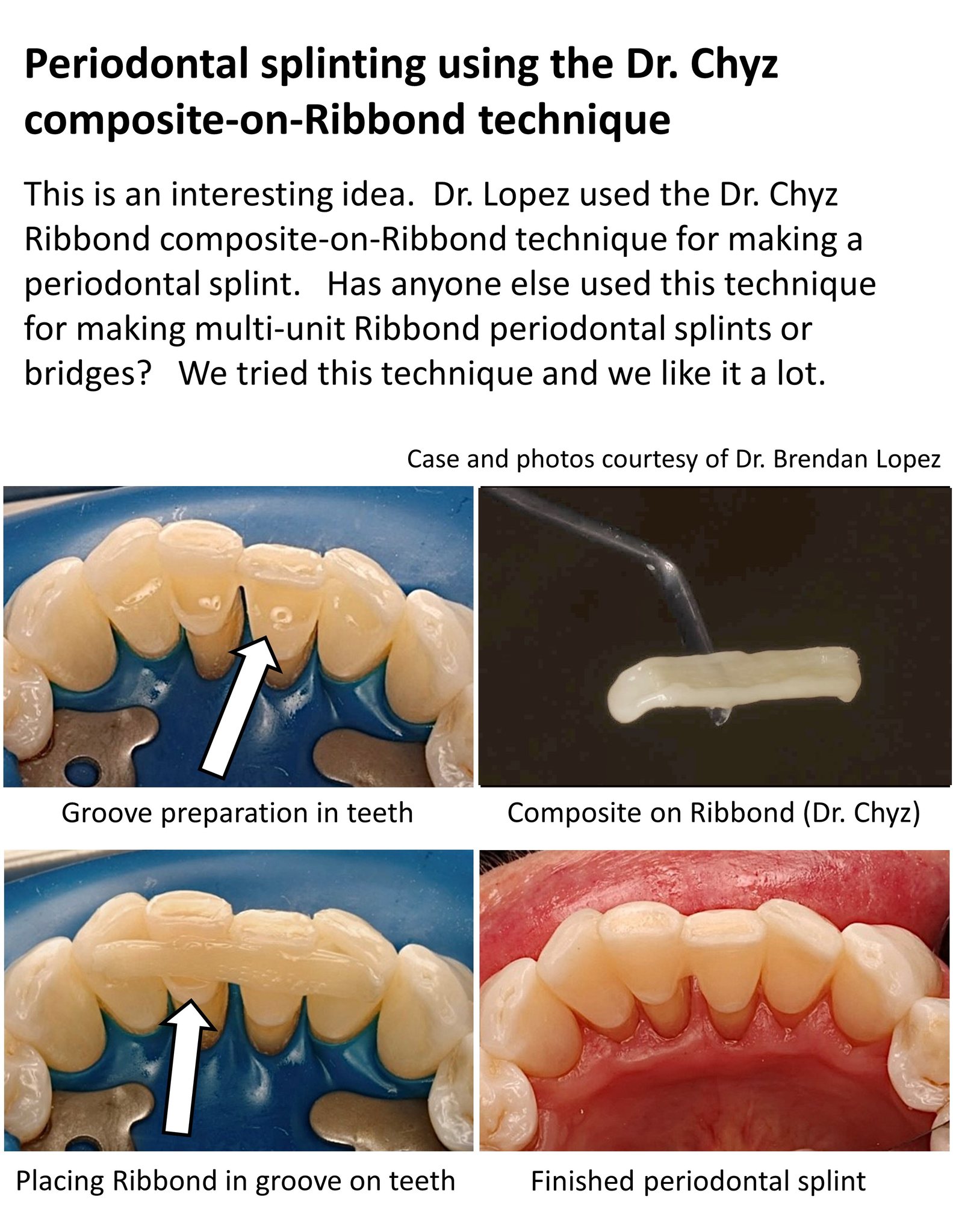 Ribbond, Inc. - Thank you Dr. Narvekar for giving us this case to post ...