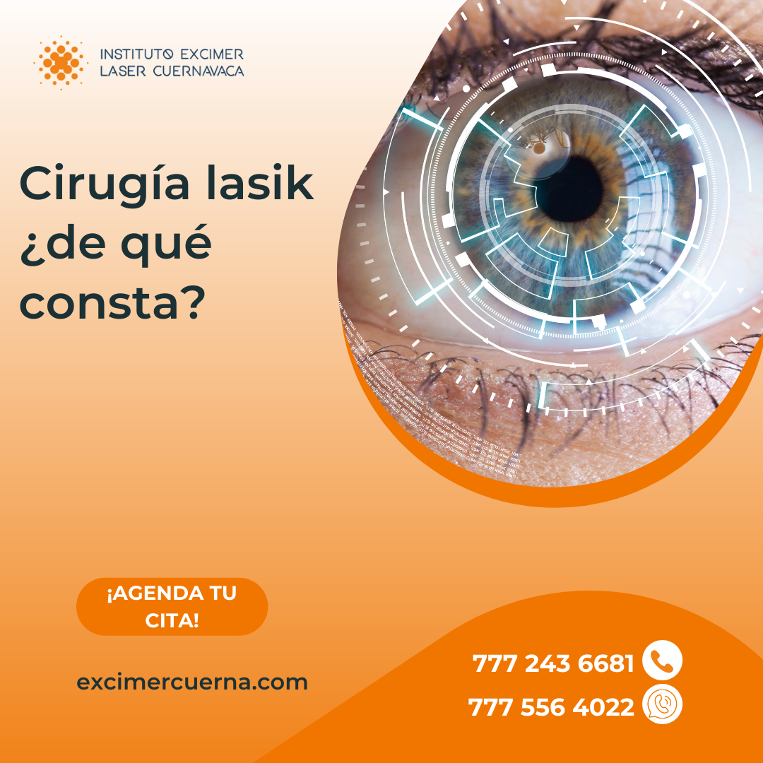 La cirugía lasik es... - Instituto Excimer Láser Cuernavaca
