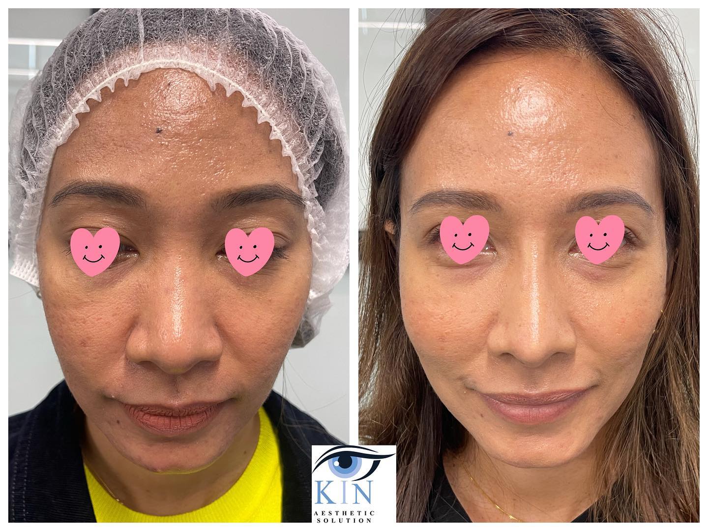 KiN Aesthetic Solution | Kuala Lumpur