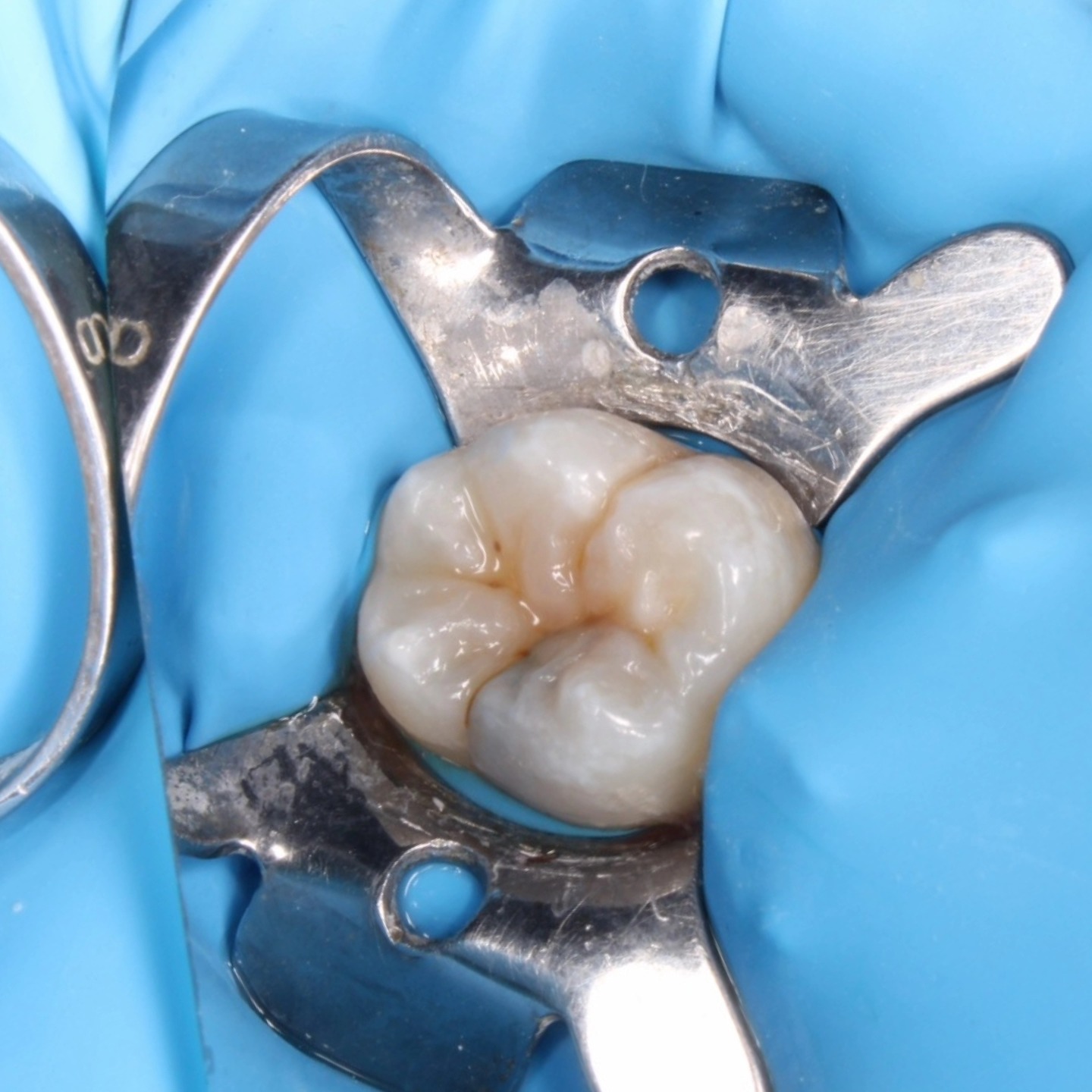 Tree Dent Consultorio Dental | Tuxtla Gutiérrez