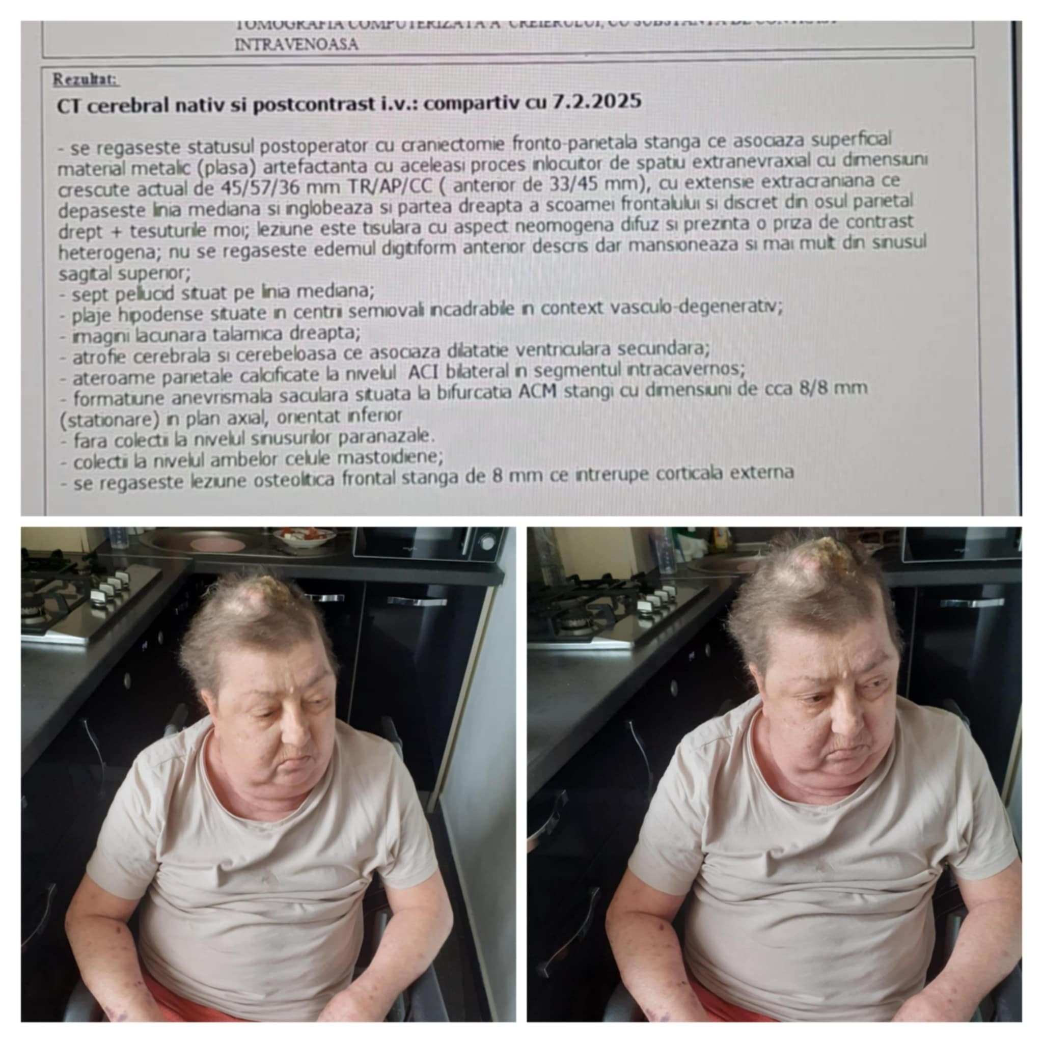 https://gofund.me/6ff8fe9a JASNA ŠEČIĆ SWIFT: UNCRBA22 IBAN 