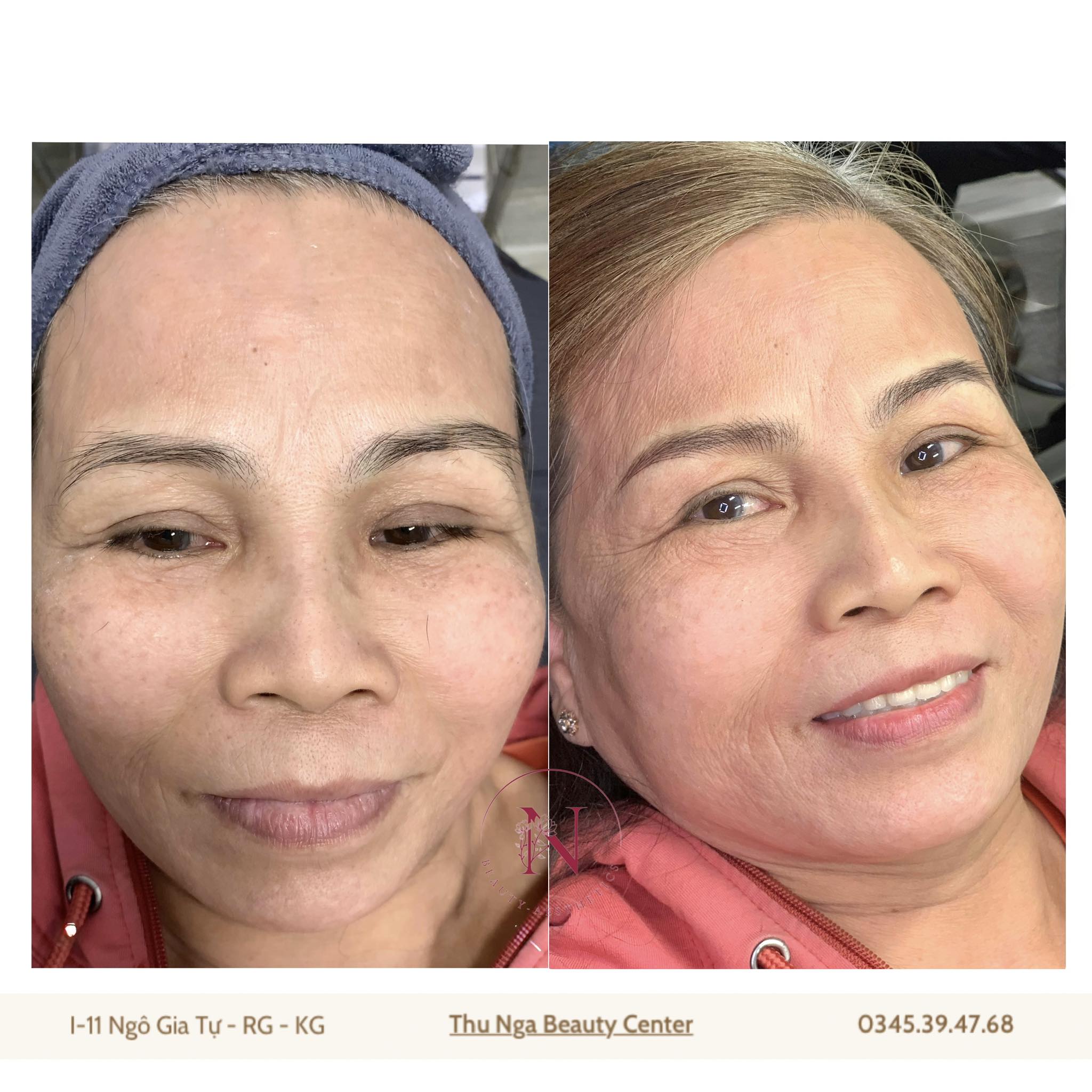 Thẩm Mỹ Thu Nga | Rach Gia