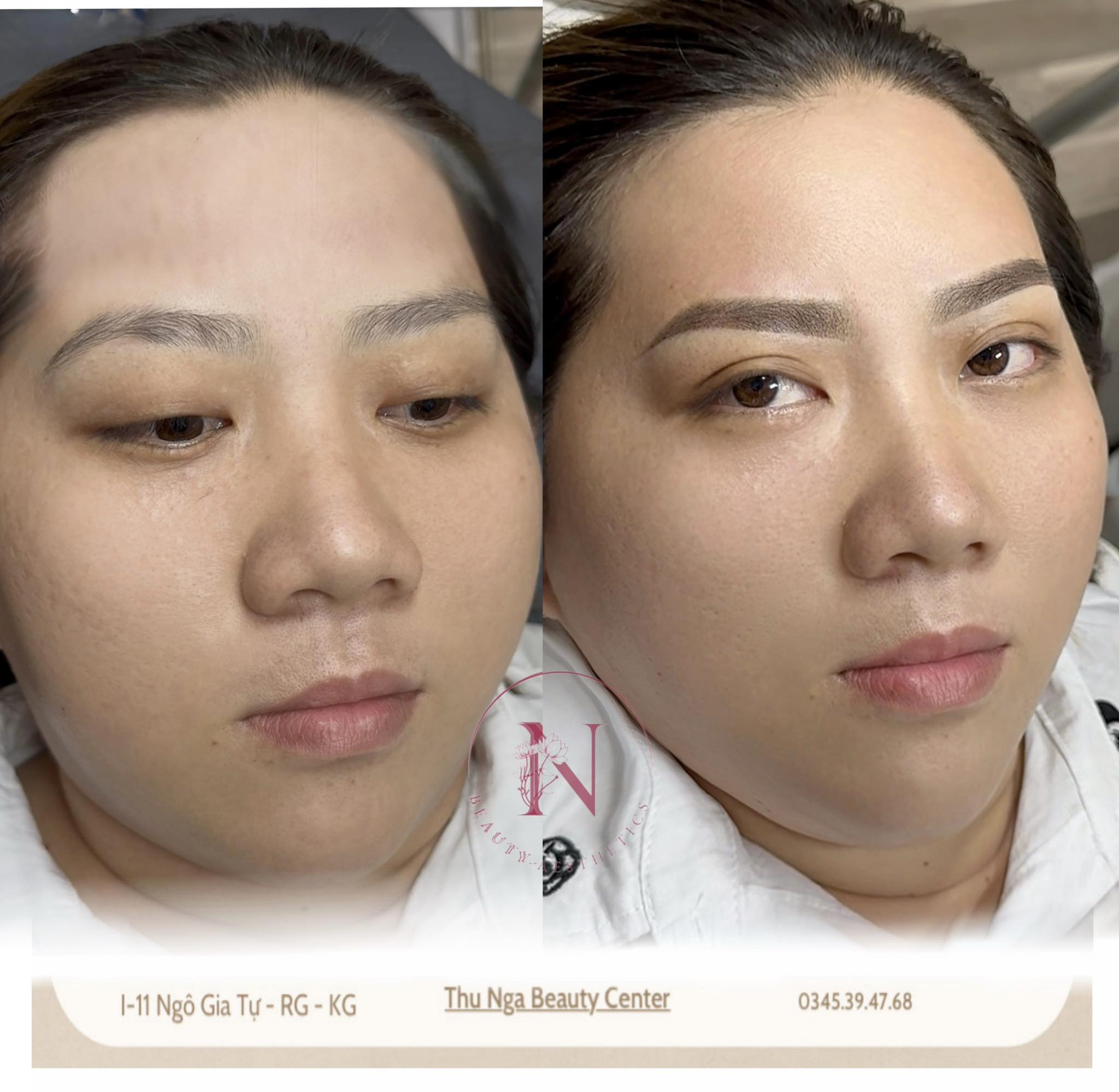 Thẩm Mỹ Thu Nga | Rach Gia