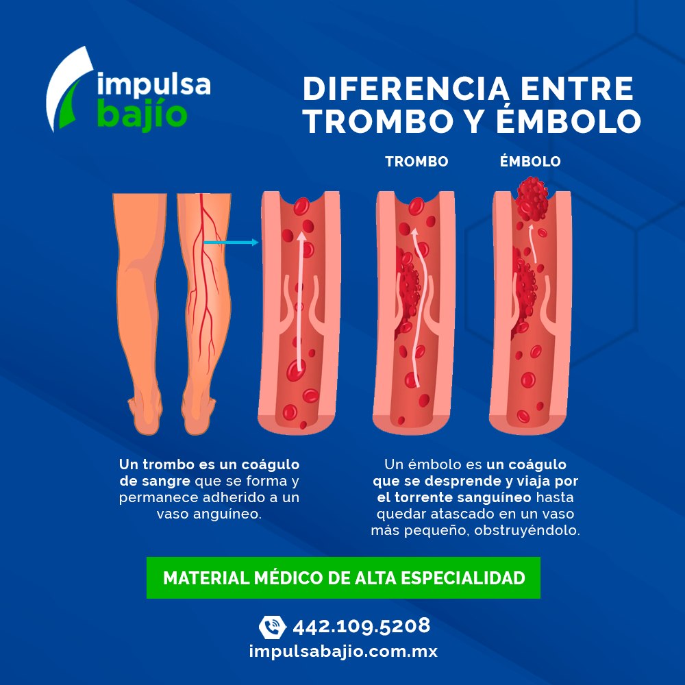Impulsa - Conoce las diferencias entre un trombo y un émbolo.🩸 Su ...