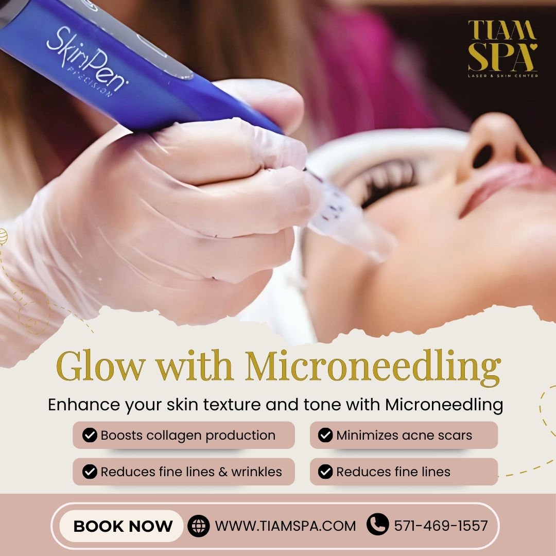 Microneedling for smooth and glowing skin