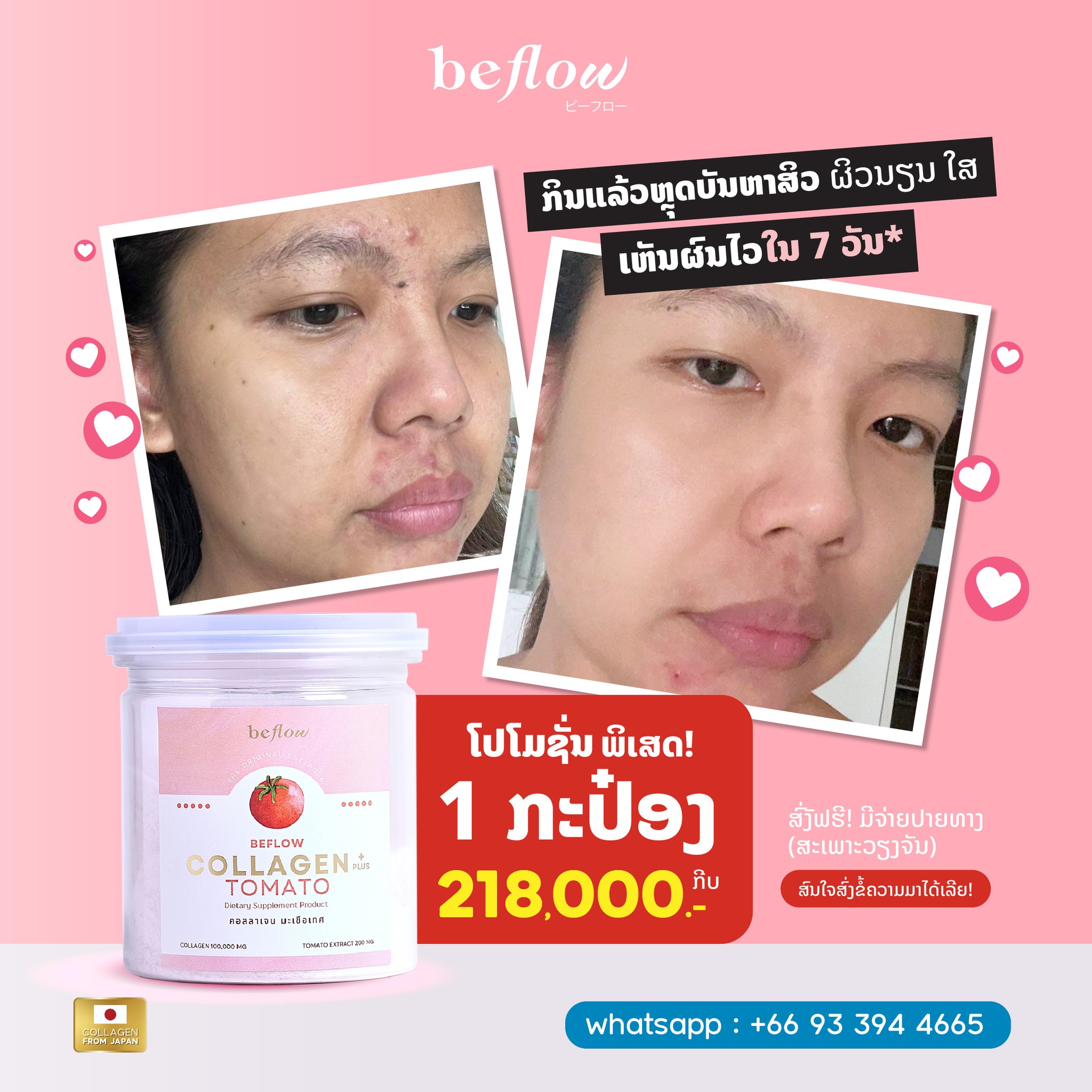 Beflow collagen : ປະເທດລາວ