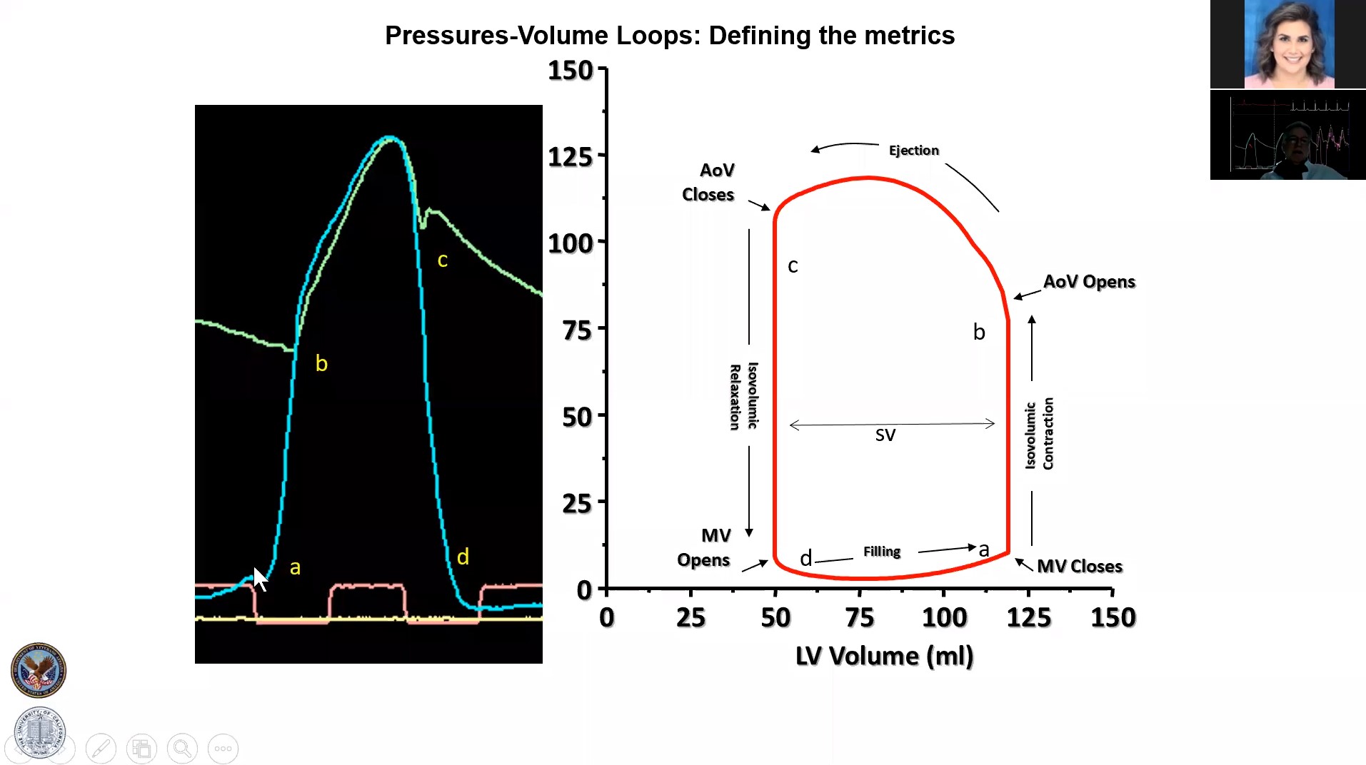 Wondr Medical - The basics of pressure waveform analysis