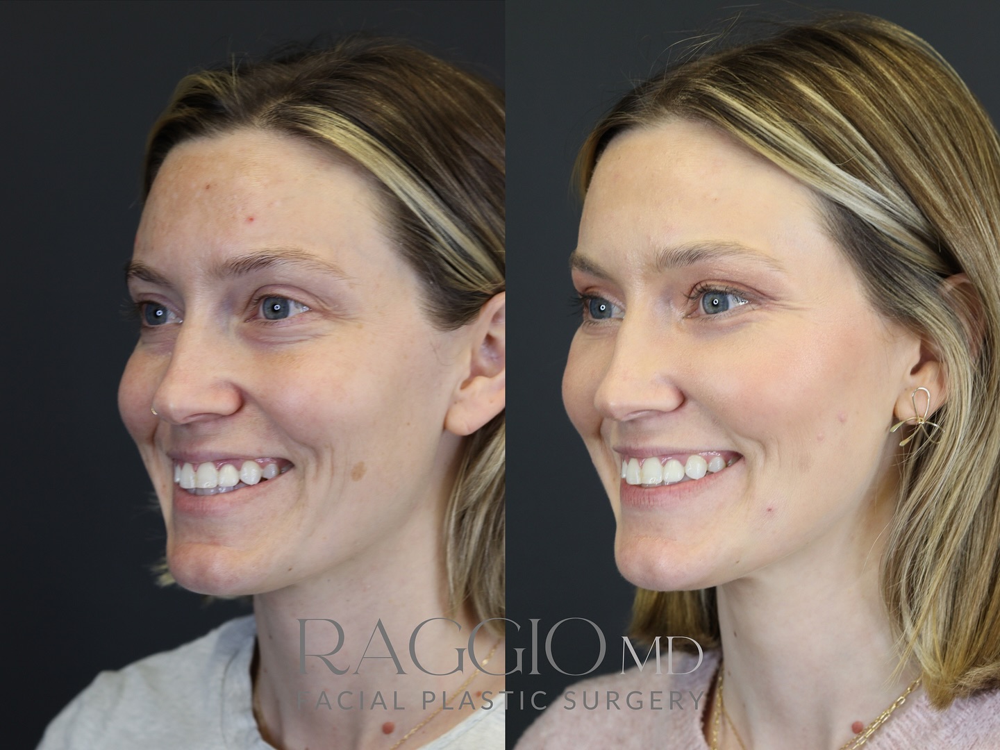 Dr. Blake Raggio | Birmingham AL