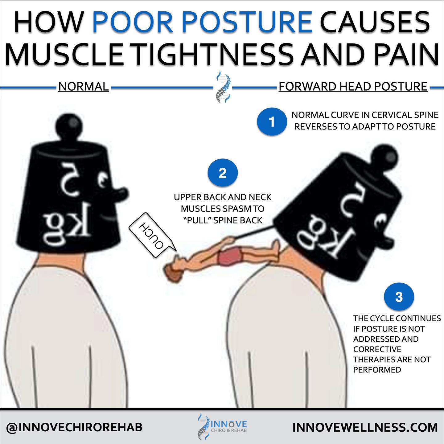 Innove Chiro and Rehab - With too much screen time, poor posture, and ...