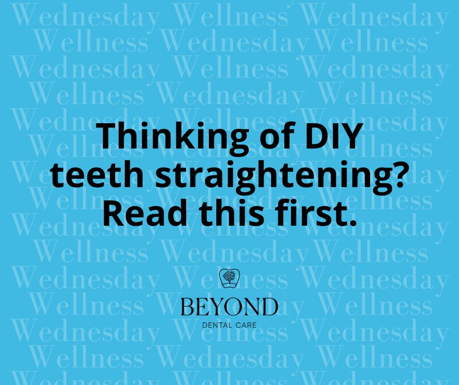 Beyond - Wellness Wednesday: Let’s talk DIY teeth straightening... and ...