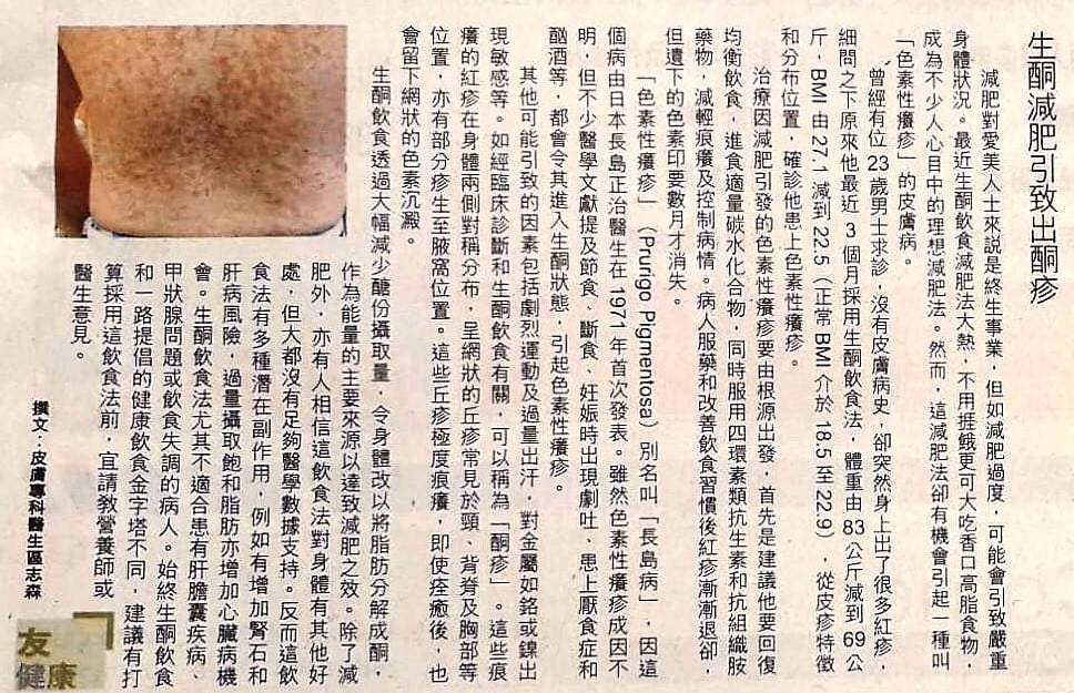#生酮減肥 引致出 #酮疹 ~~~~~~~~~~~~~~~~... - Dr Sam 區志森皮膚科專科醫生 | Facebook