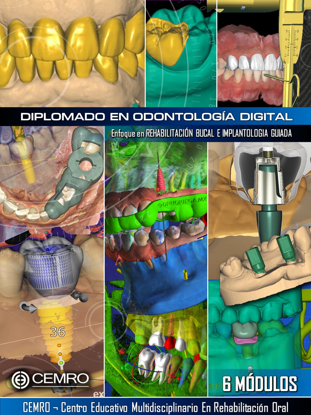 OdontoTV - #Diplomado en #ODONTOLOGIA #DIGITAL #EXOCAD #EXOPLAN # ...