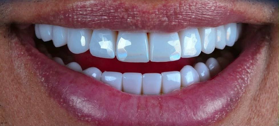 A smile designed with precision of a masterpiece. With the launch
