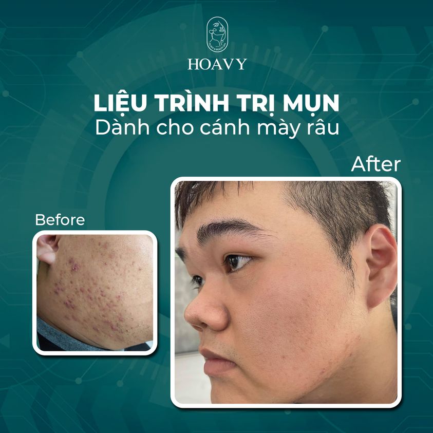 Thẩm Mỹ Viện Nam-hoavygroup