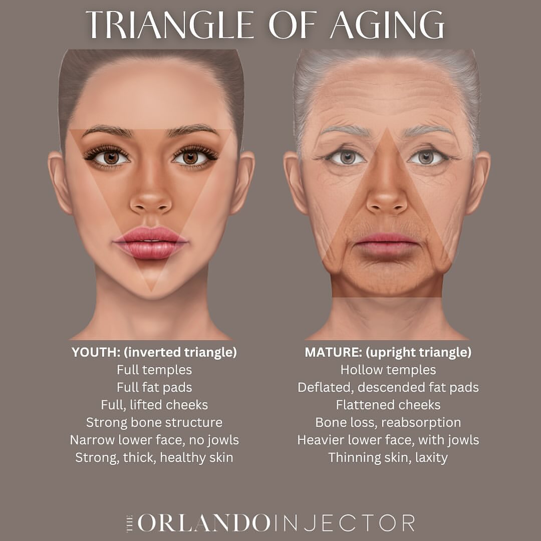Rock - Repost from @theorlandoinjector_ • The ‘Triangle of Aging’ or ...