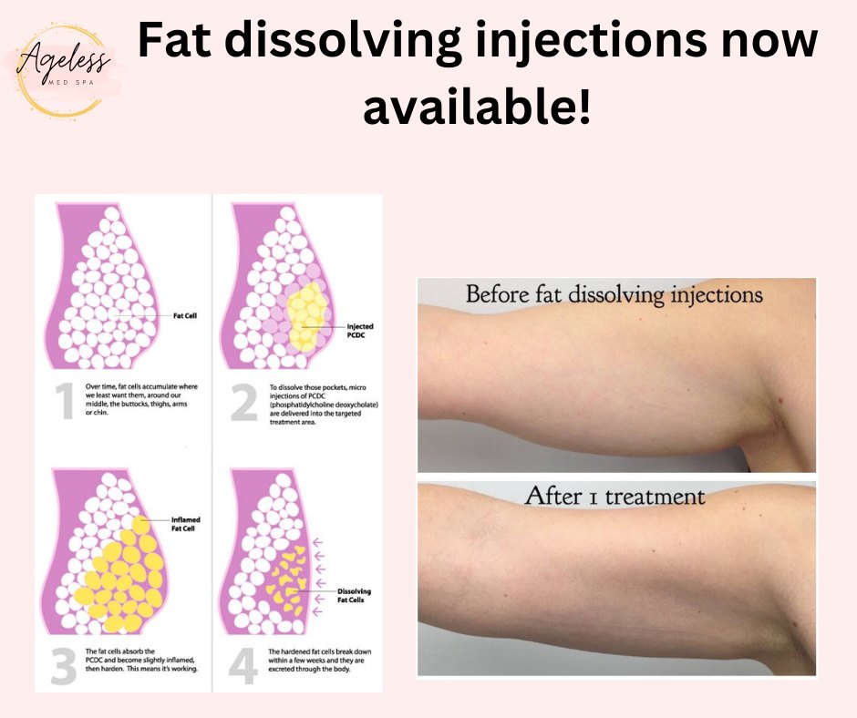 Ageless Appeal Med Spa - Liquid Lipo Fat Dissolvent is now available ...