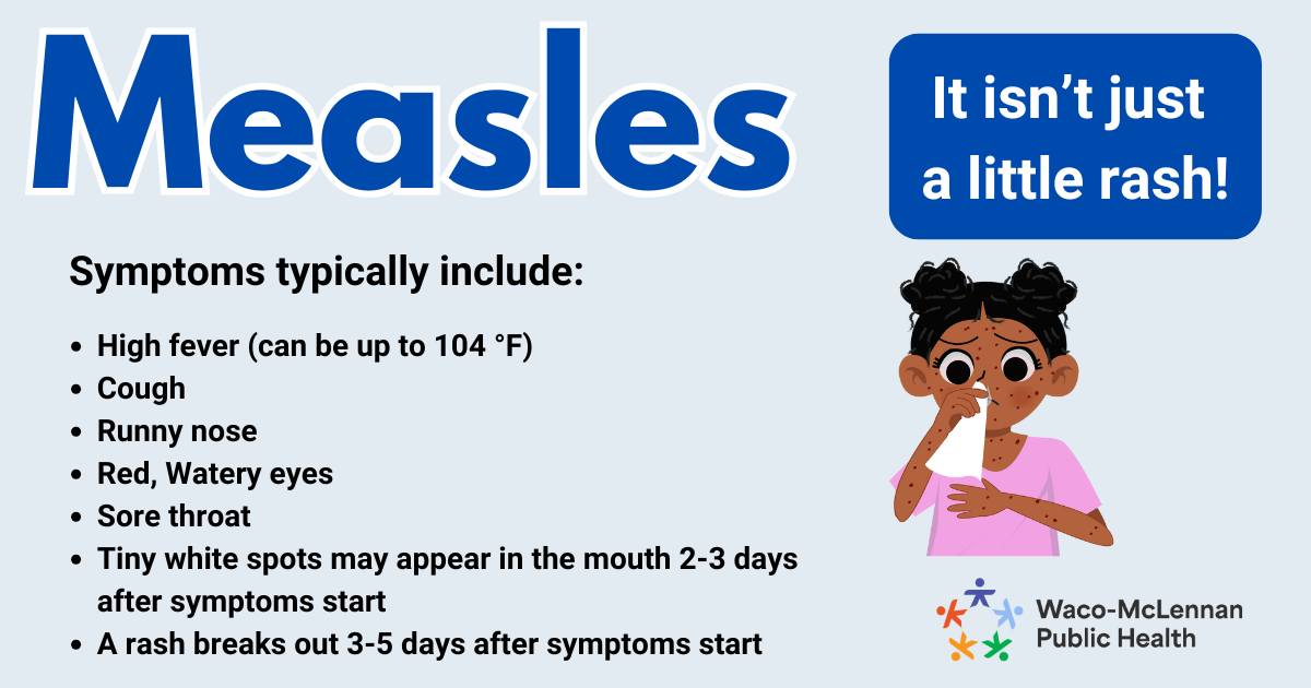 Waco-McLennan - Measles infection causes a rash to appear, alongside ...