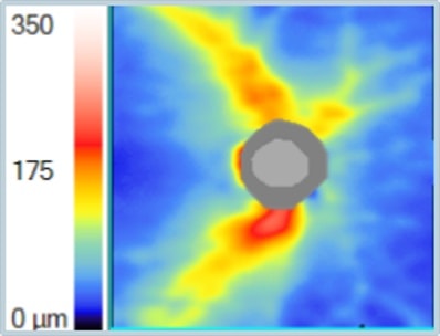 The RNFL Thickness Heat... - Ophthalmology-Notes And Synopses | Facebook