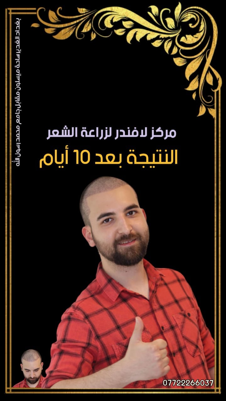 مركز لافندر لزراعة الشعر Lavender Hair Transplant Center Facebook