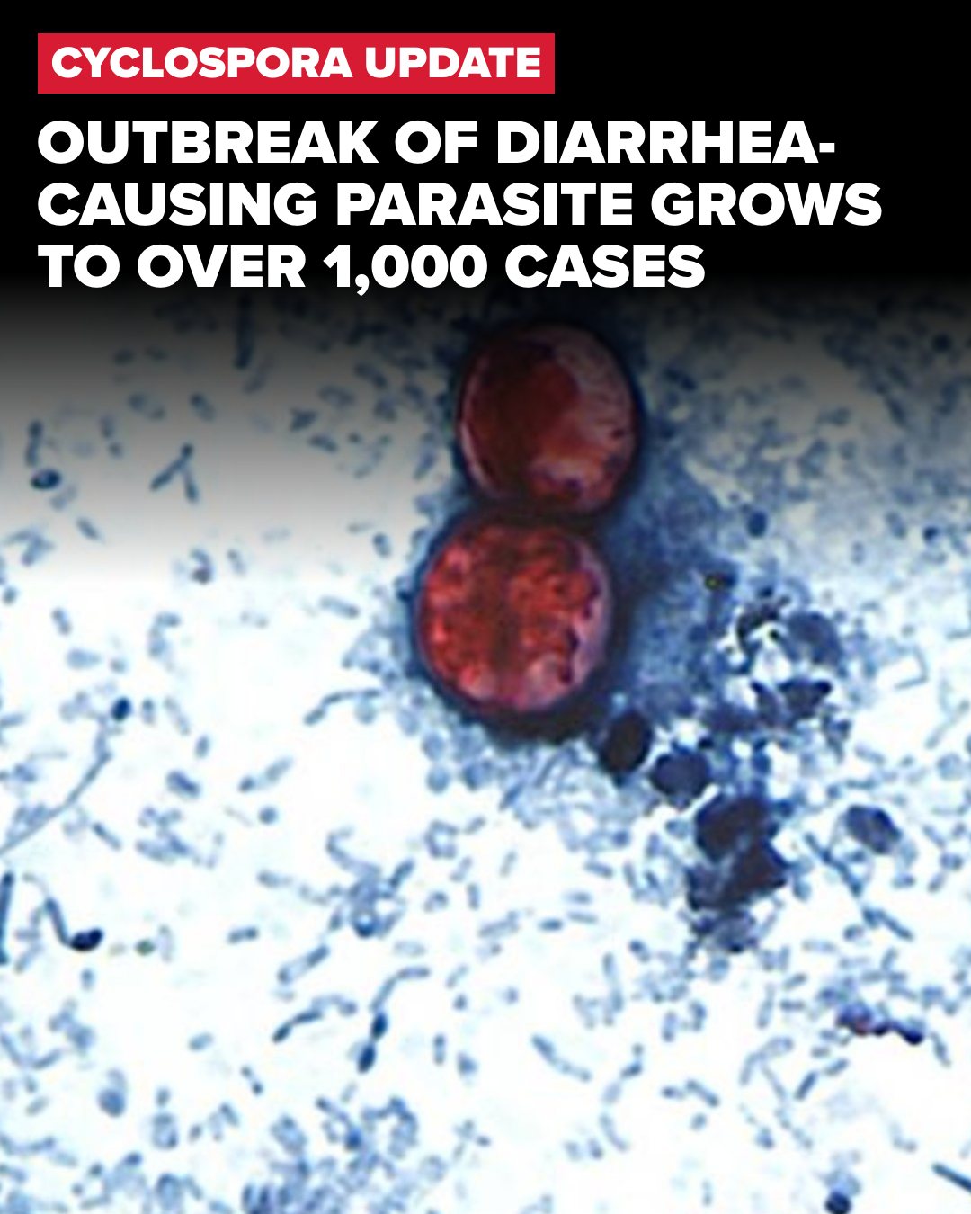 glp-1 diarrhea lawsuit in michigan As of Thursday, more than 300 cases of cyclosporiasis, an intestinal infection, have been confirmed Michigan. Dr. Jessica Shepherd explains what to know. | ABC News Live glp-1 diarrhea lawsuit in michigan