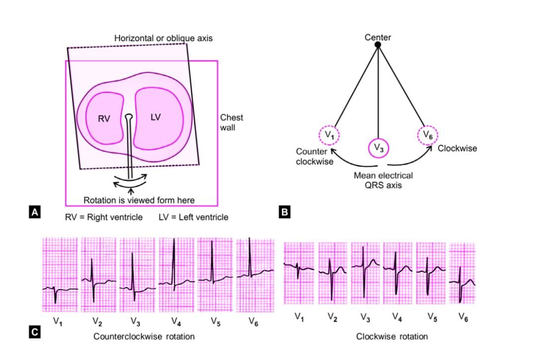 Cardiophilia - 🫀 Electrical Rotation of the Heart—A hidden... | Facebook