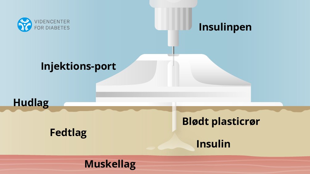 Klinik for fodterapi v/grandtklinik | Østerbro