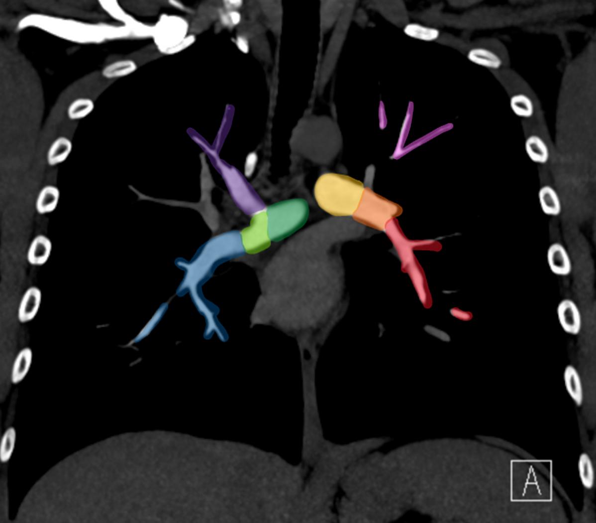 Dr/Hytham Nafady - New Approach to Radiology
