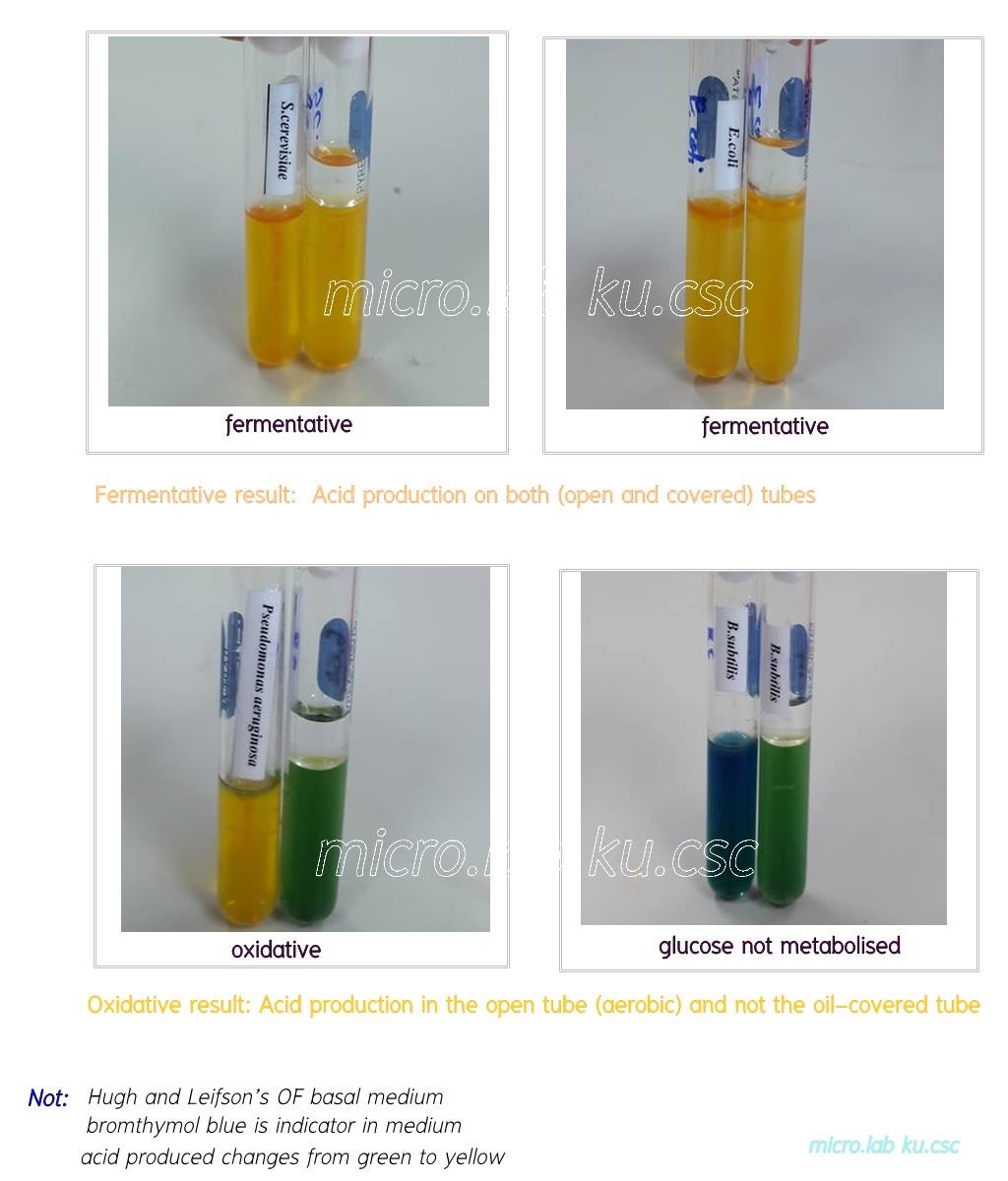 The oxidative-fermentative test - Microbiology Microbiologist