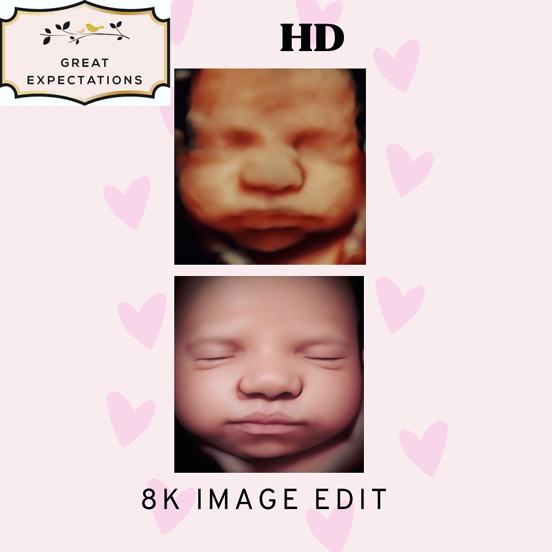 Now offering 8k... - Great Expectations 3D/HD Ultrasounds